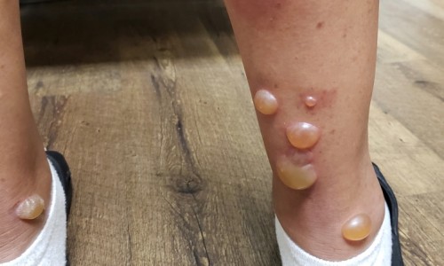 哺乳期间什么不能吃-喂奶时不可以吃什么专区_喂奶可以吃什么水果专区_在喂奶期间什么不能吃什么水果蔬菜网